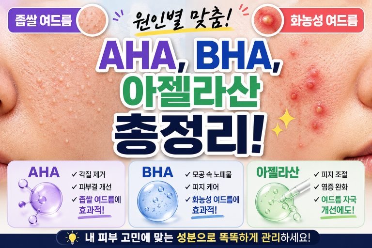 좁쌀 여드름과 화농성 여드름 원인별 맞춤 성분(AHA, BHA, 아젤라산) 총정리